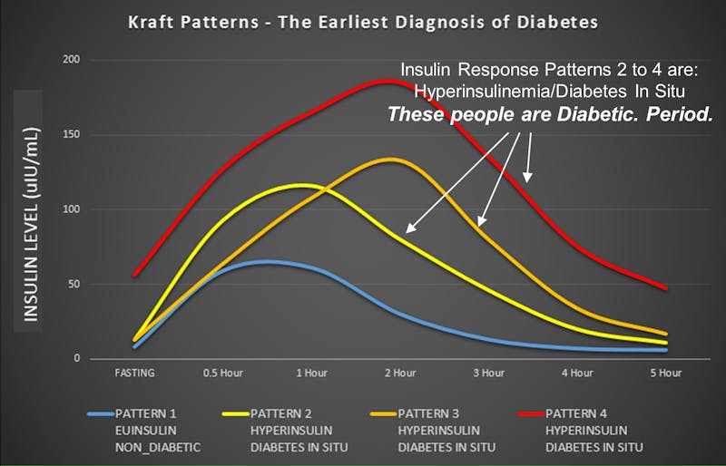 Early sign of T2DM: elevated insulin