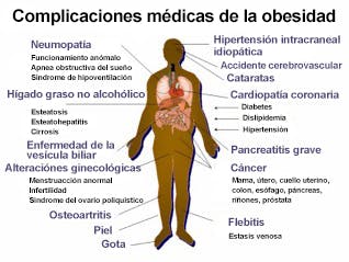 Complicaciones médicas de la obesidad