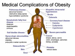 Medical complications of obesity